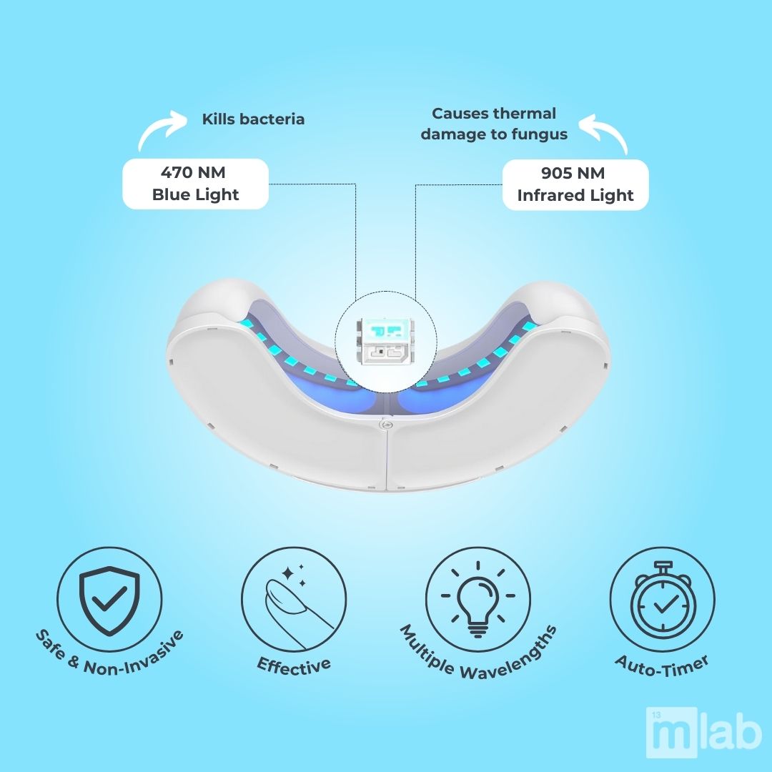 Nail Fungus Laser Treatment | Non-Invasive, Effective & Safe Solution for Healthy Nails