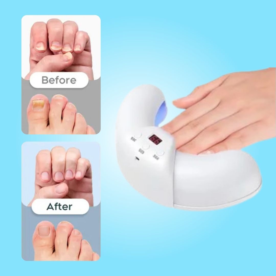 Nail Fungus Laser Treatment | Non-Invasive, Effective & Safe Solution for Healthy Nails
