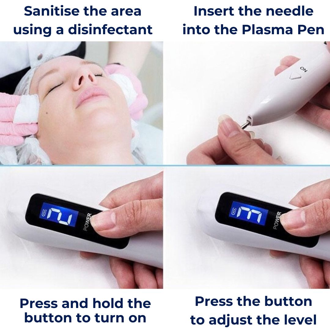 Non-Invasive Laser Plasma Pen for Freckle, Best Skin Tag Removal, Spot, Mole and Tattoo Removal at Home