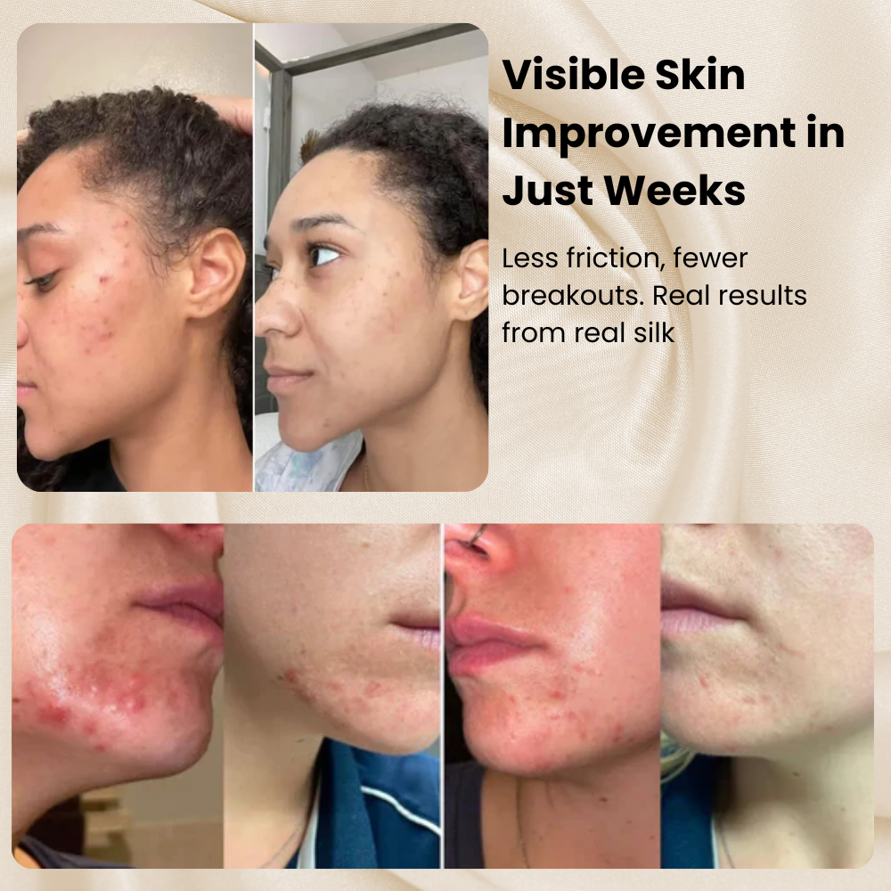 Silk Pillowcase – 100% Real Mulberry Silk for Hair & Skin – Cooling, Frizz-Free & Anti-Wrinkle Pillowcase UK