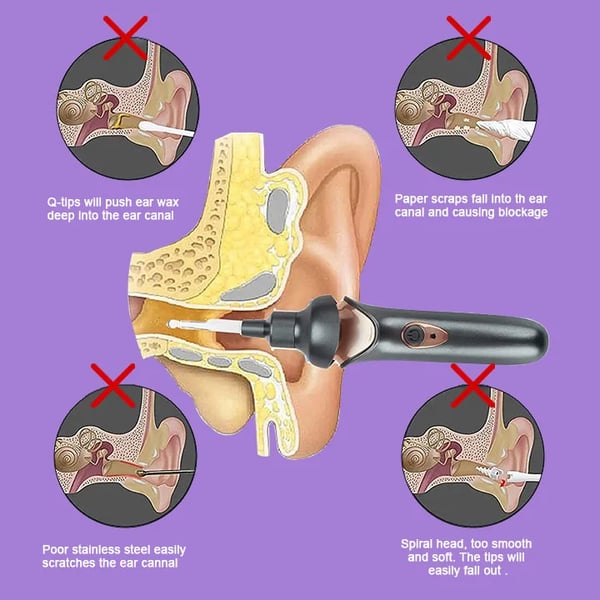 EarClear™ | Painless Ear Wax Removal Kit for Safe & Effective Cleaning for Adults & Kids