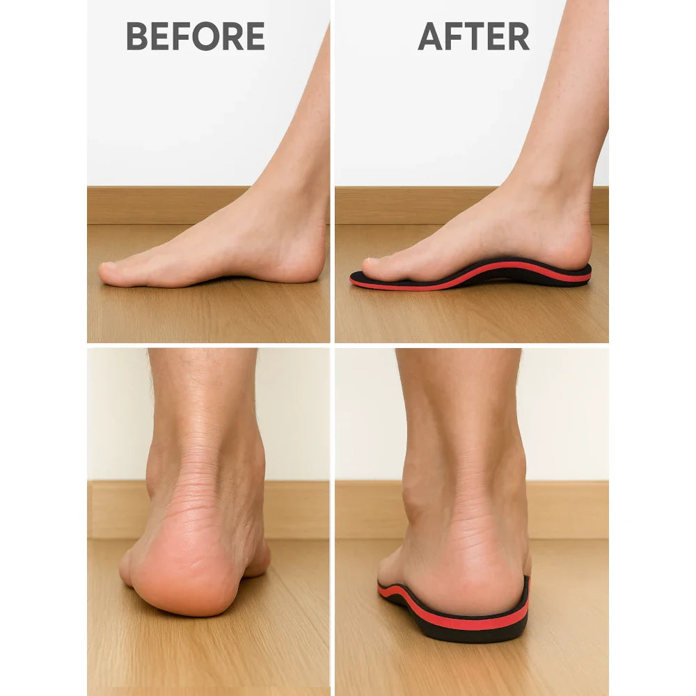 High Arch Support Insoles for Plantar Fasciitis | Firm, Resilient Design for Plantar Fasciitis, Flat Feet & Foot Alignment Issues