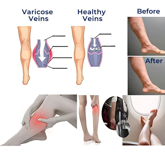 CircuEase Compression Socks | Soft, Highly Elastic Design for Muscle Recovery & Circulation Enhancement for Professionals on Their Feet