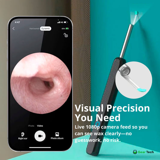 EarScope Pro Ear Wax Removal Kit | High-Resolution Camera & LED Lights for Safe Home Use