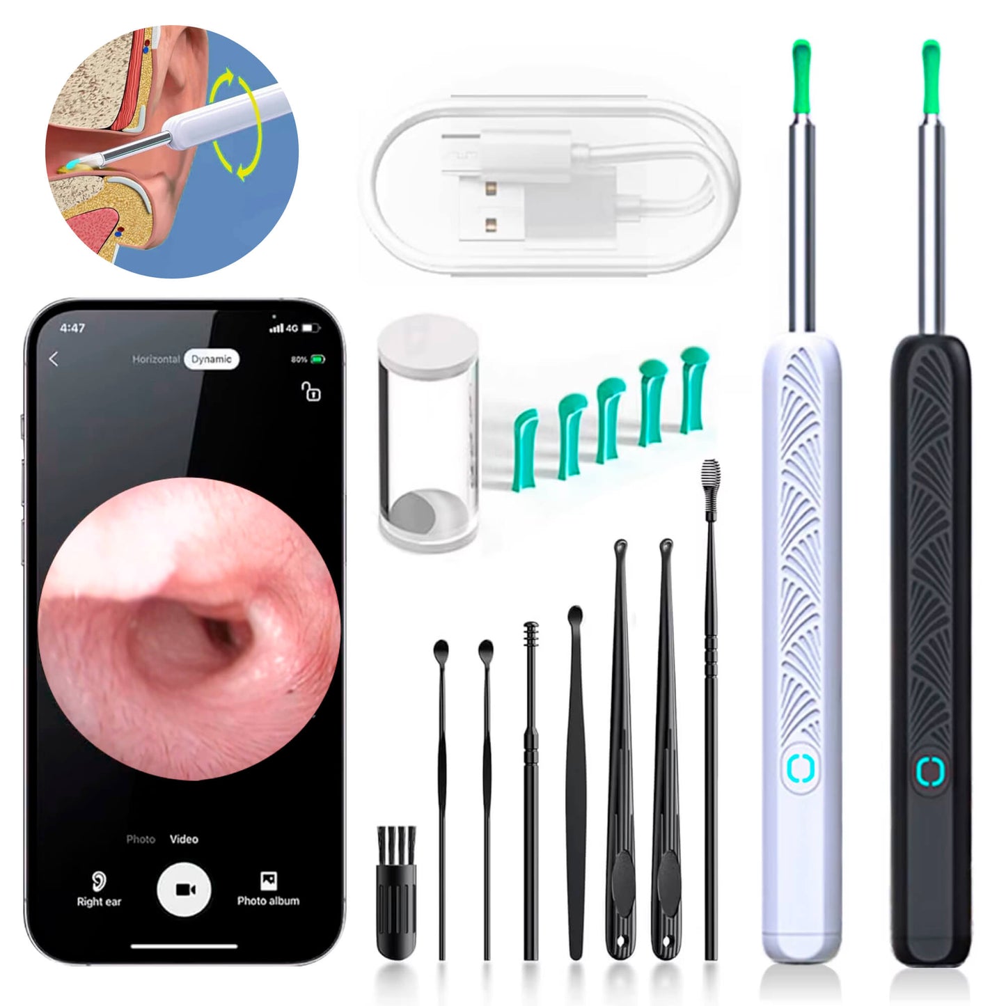 EarScope Pro Ear Wax Removal Kit | High-Resolution Camera & LED Lights for Safe Home Use