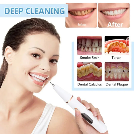 Ultrasonic Teeth Cleaning Device | 38 kHz Ultrasound, LED Light & USB Fast Charging for Home Dental Care