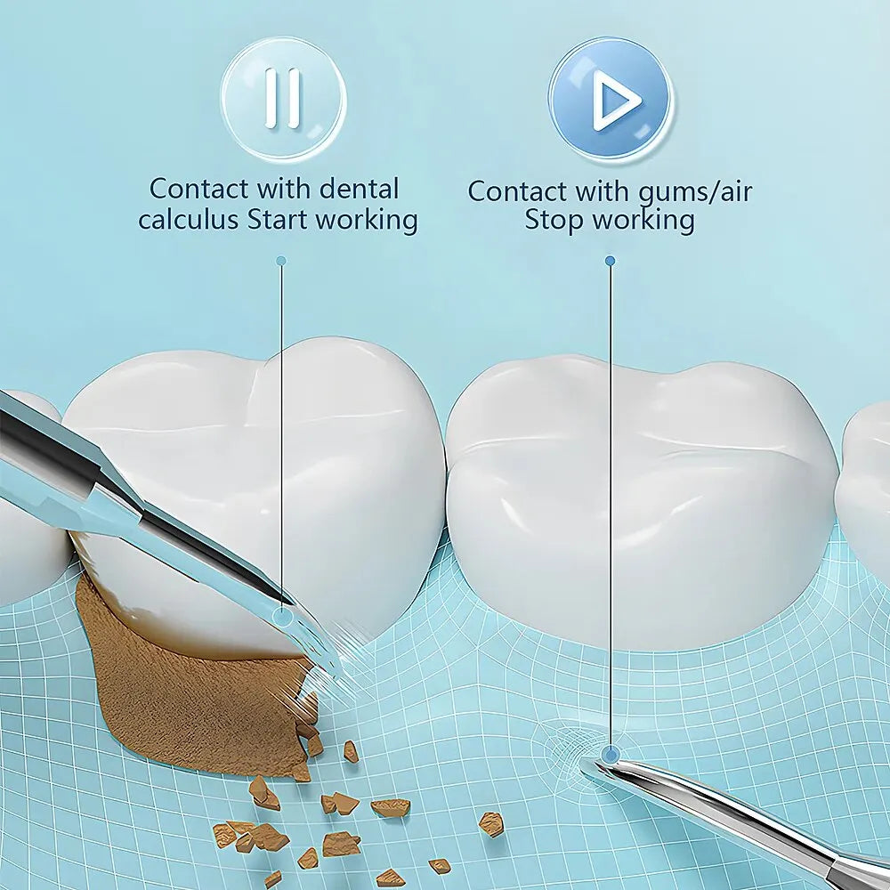 Ultrasonic Teeth Cleaning Device | 38 kHz Ultrasound, LED Light & USB Fast Charging for Home Dental Care