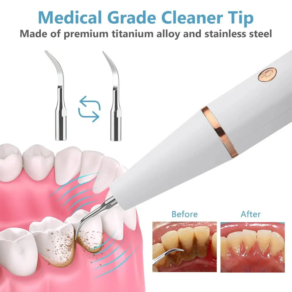 Ultrasonic Teeth Cleaning Device | 38 kHz Ultrasound, LED Light & USB Fast Charging for Home Dental Care