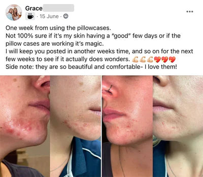 Silk Pillow Case (2 Pack) | Hypoallergenic, Anti-Aging & Ideal for Hair and Skin Care