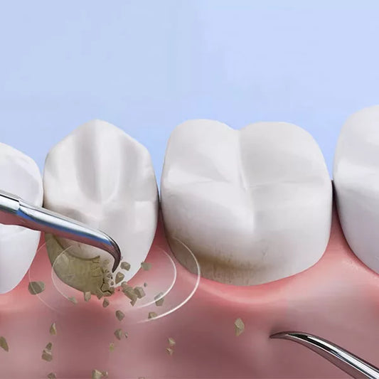 Dental Calculus Plaque Removal Tool | Tooth Cleaning Tool for Dental Hygiene