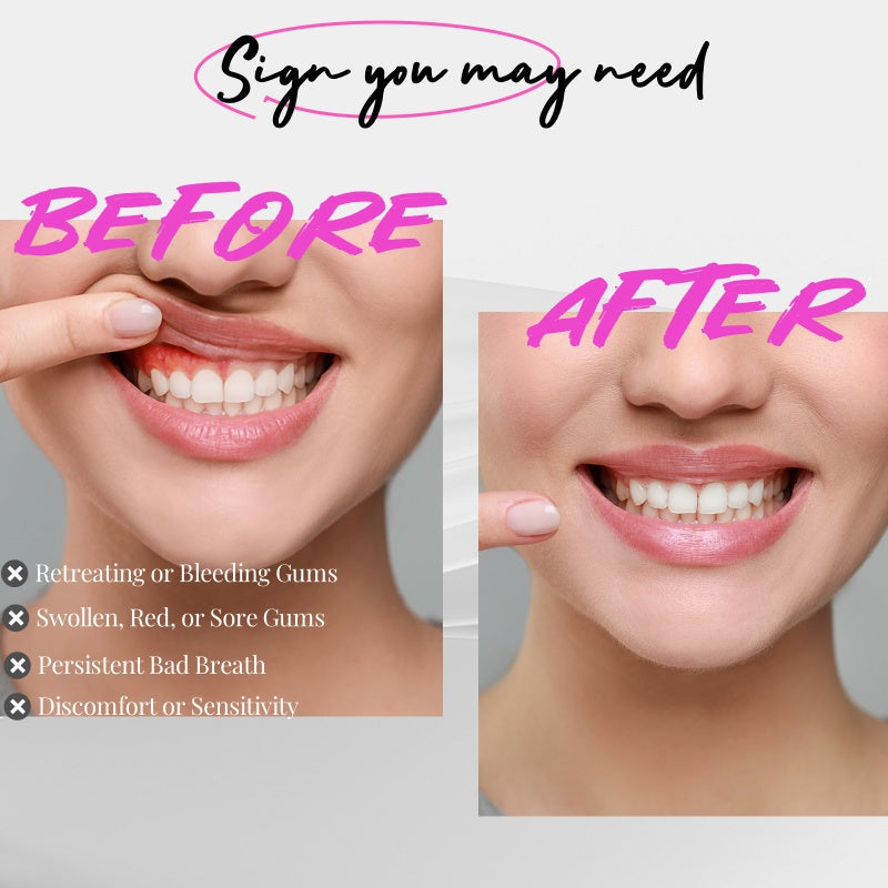 Effective Gum Disease Treatment – Red Light Therapy for Swollen Gums & Receding Gums
