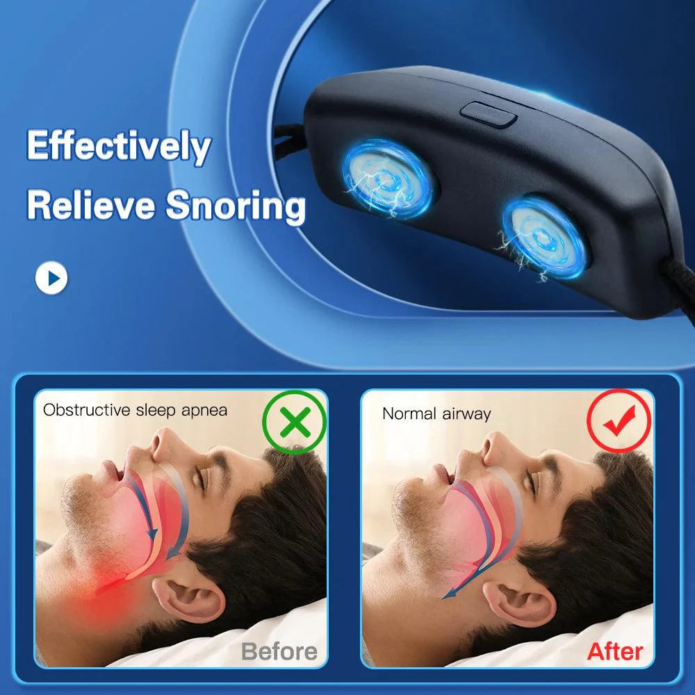 Smart Anti Snoring Device EMS Pulse Stop Snore Effective Aid for Snoring Prevention