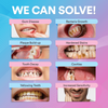 Image of PureSmile™ Ultrasonic Tooth Cleaner | Advanced Teeth Cleaning Technology