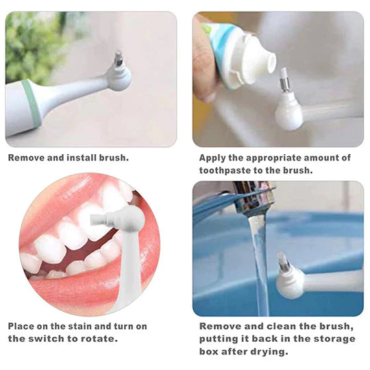 Home Teeth Scaling Kit – Tooth Plaque Remover & Teeth Polisher