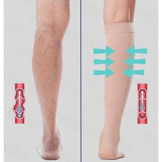 Support Tights for Varicose Veins – Compression Stockings to Improve Circulation & Relieve Swollen Legs
