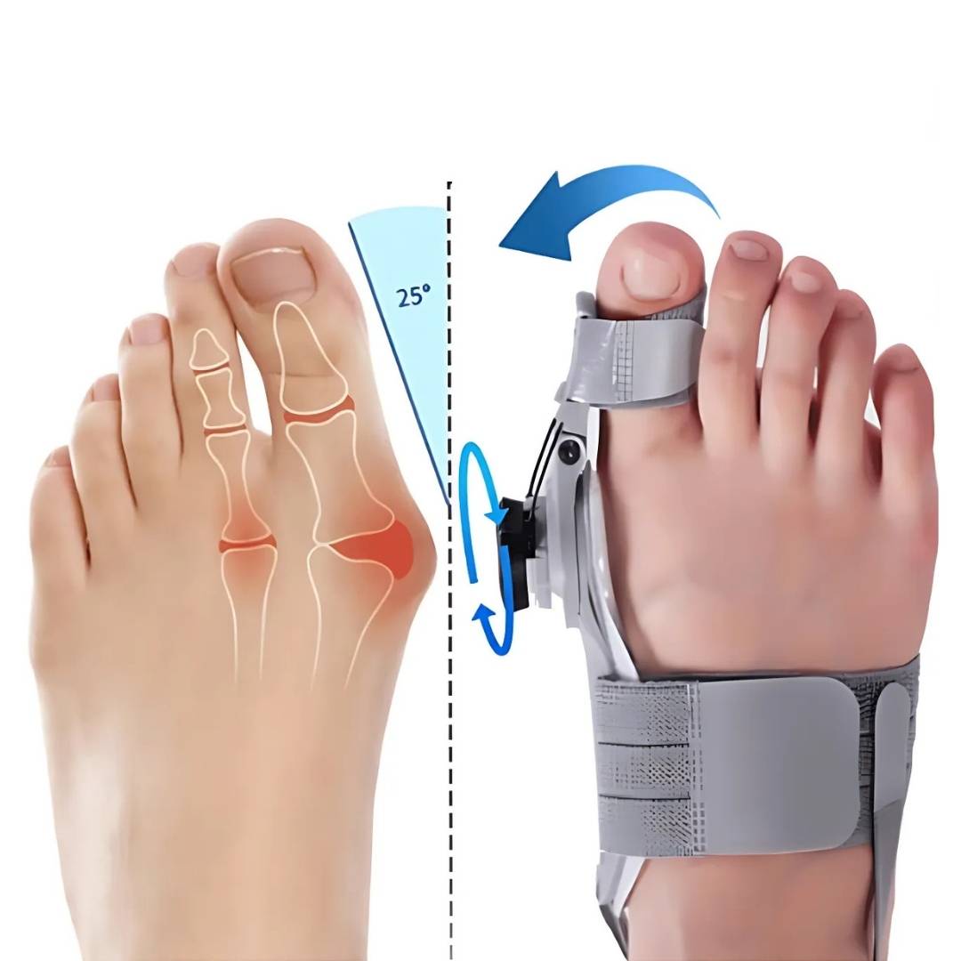 Toe Corrector for Bunions – Adjustable Support Pad to Alleviate Pain & Realign Toes