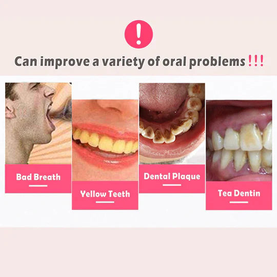 Tooth Plaque Remover | Electric Dental Cleaning Device for Effective Oral Hygiene at Home