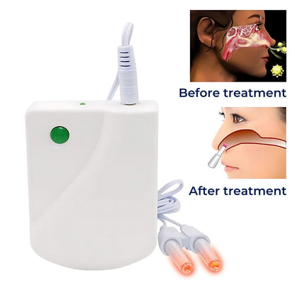 Infrared Therapy Device for Allergic Rhinitis and Runny Nose Relief, Comfortable Nasal Congestion Treatment