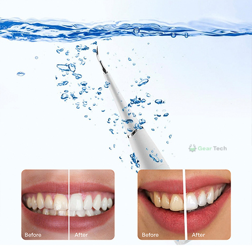 Tooth Stain Remover | Effective Dental Tool for Plaque Removal and Oral Hygiene