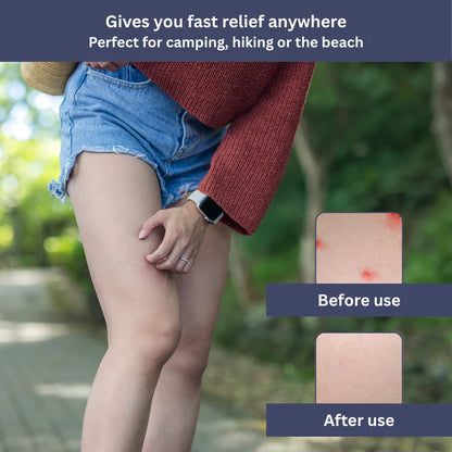InstaRelief Sting Healer | Fast-Acting, Natural Formula for Insect Bites & Skin Irritations