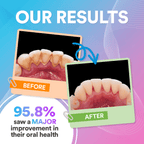 Dental Wireless 5-In-1 Water Flosser Pro | Advanced Water Flossing for Healthier Teeth