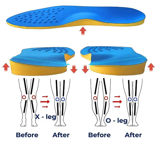 Insoles for Supination – Orthopedic Foot Support for Under-Pronated Feet & Daily Comfort