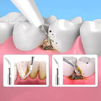 Tartar Removal & Plaque Cleaner Kit – Ultrasonic Teeth Cleaner Device for At-Home Deep Dental Hygiene
