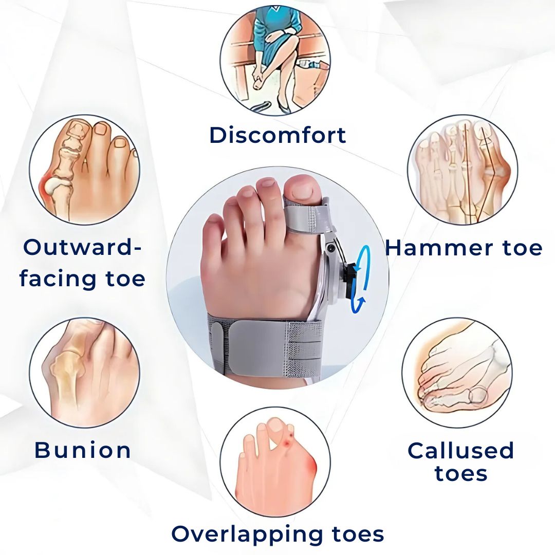 Toe Corrector for Bunions – Adjustable Support Pad to Alleviate Pain & Realign Toes