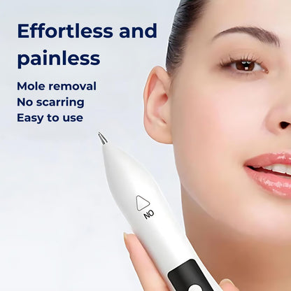 Non-Invasive Laser Plasma Pen for Freckle, Best Skin Tag Removal, Spot, Mole and Tattoo Removal at Home