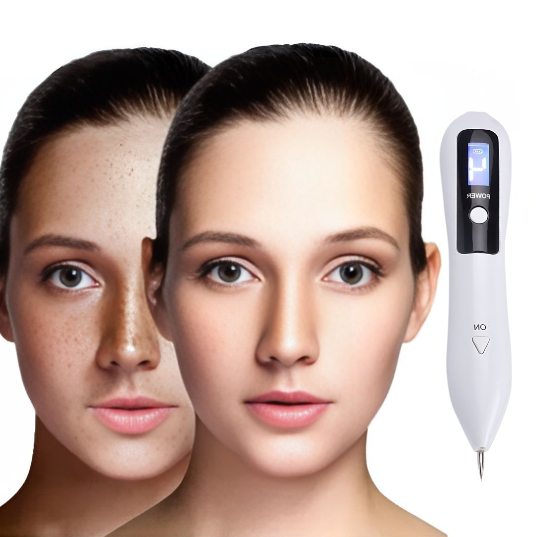 Non-Invasive Laser Plasma Pen for Freckle, Best Skin Tag Removal, Spot, Mole and Tattoo Removal at Home