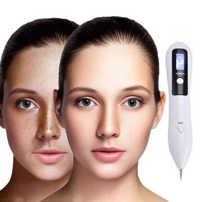 Non-Invasive Laser Plasma Pen for Freckle, Best Skin Tag Removal, Spot, Mole and Tattoo Removal at Home