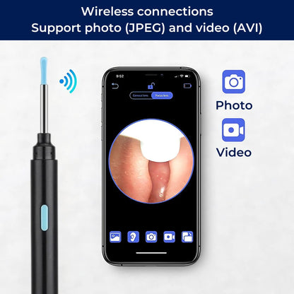 Ear Wax Removal Tool with Camera | Smart Otoscope Ear Cleaner | HD Visual Endoscope with 6 LEDs | Wi-Fi App