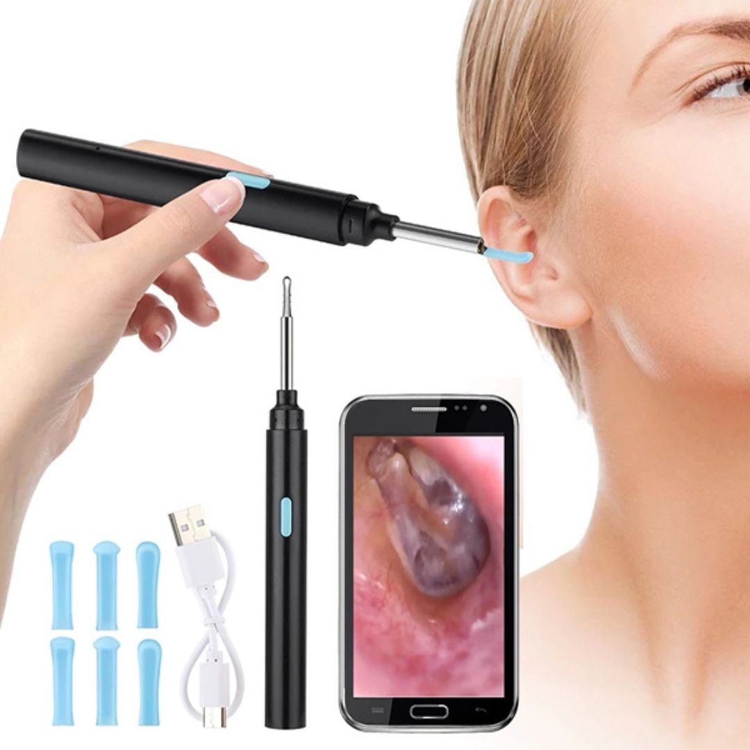 Ear Wax Removal Tool with Camera | Smart Otoscope Ear Cleaner | HD Visual Endoscope with 6 LEDs | Wi-Fi App