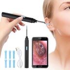 Ear Wax Removal Tool – Earscope Pro Smart Visual Ear Cleaner Kit for Safe and Precise Home Use