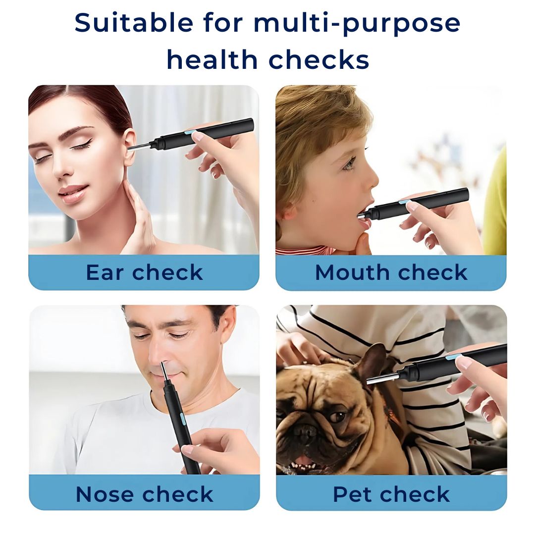 Ear Wax Removal Tool with Camera | Smart Otoscope Ear Cleaner | HD Visual Endoscope with 6 LEDs | Wi-Fi App