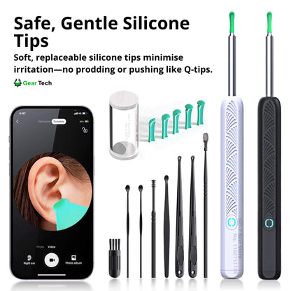 EarScope Pro Ear Wax Removal Kit | High-Resolution Camera & LED Lights for Safe Home Use