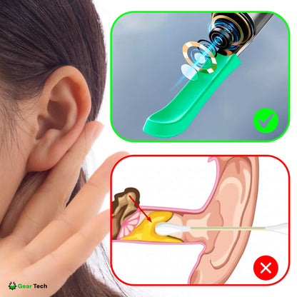 EarScope Pro Ear Wax Removal Kit | High-Resolution Camera & LED Lights for Safe Home Use