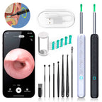 EarScope Pro Ear Wax Removal Kit | High-Resolution Camera & LED Lights for Safe Home Use