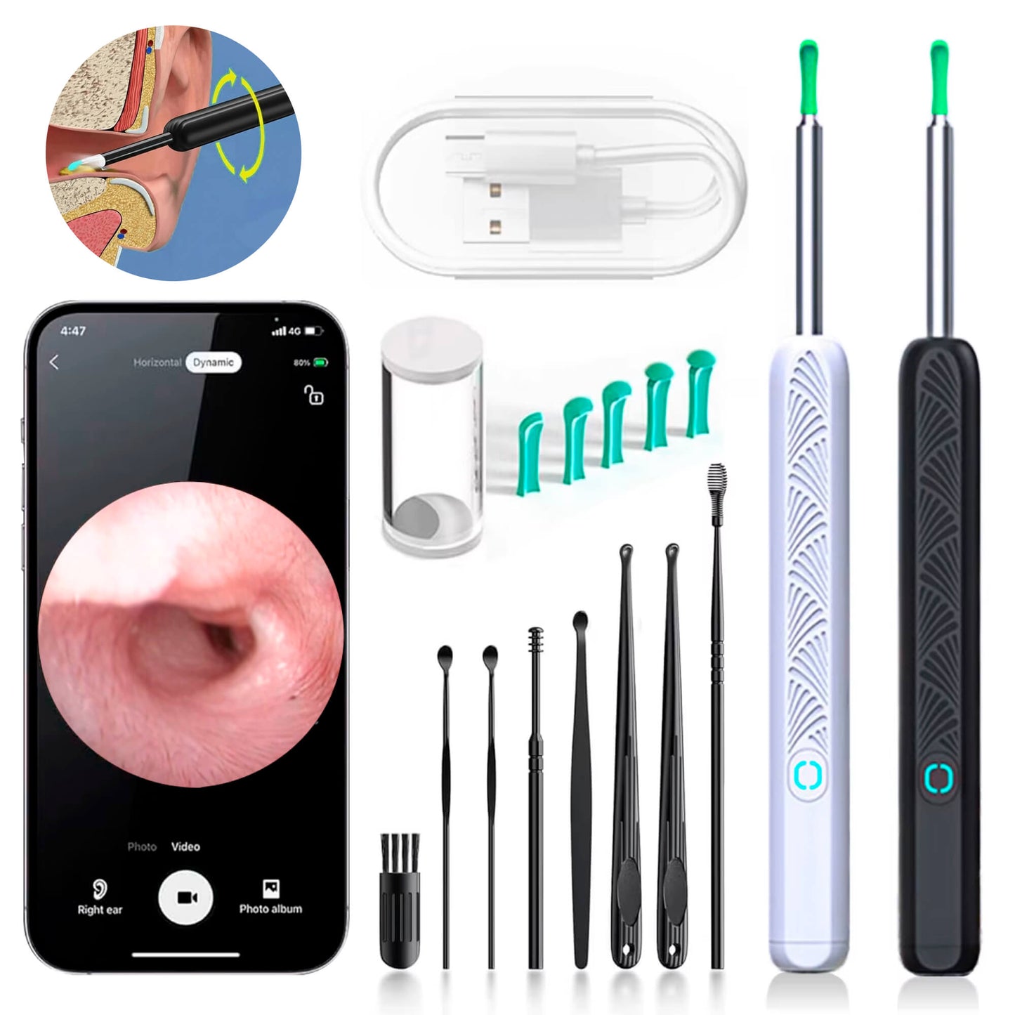 EarScope Pro Ear Wax Removal Kit | High-Resolution Camera & LED Lights for Safe Home Use