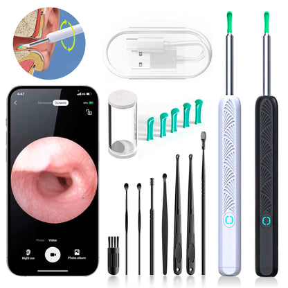 EarScope Pro Ear Wax Removal Kit | High-Resolution Camera & LED Lights for Safe Home Use