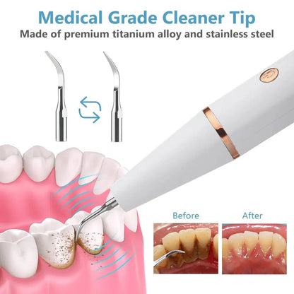 Ultrasonic Teeth Cleaning Device | 38 kHz Ultrasound, LED Light & USB Fast Charging for Home Dental Care