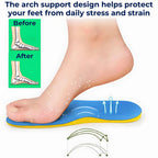 Insoles for Supination – Orthopedic Foot Support for Under-Pronated Feet & Daily Comfort