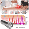 Image of Red and Blue Light Phototherapy Therapy