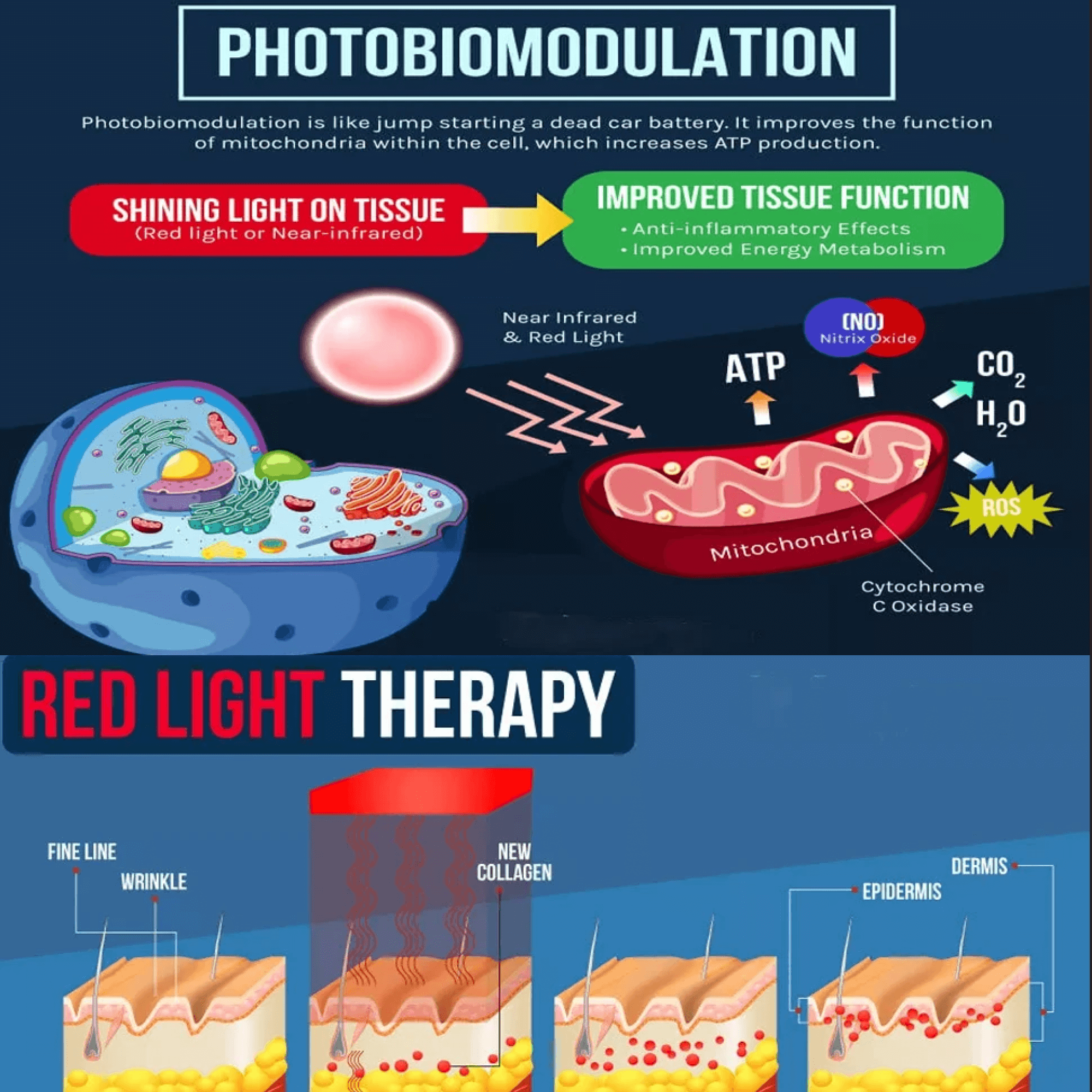 Red and Blue Light Phototherapy Therapy