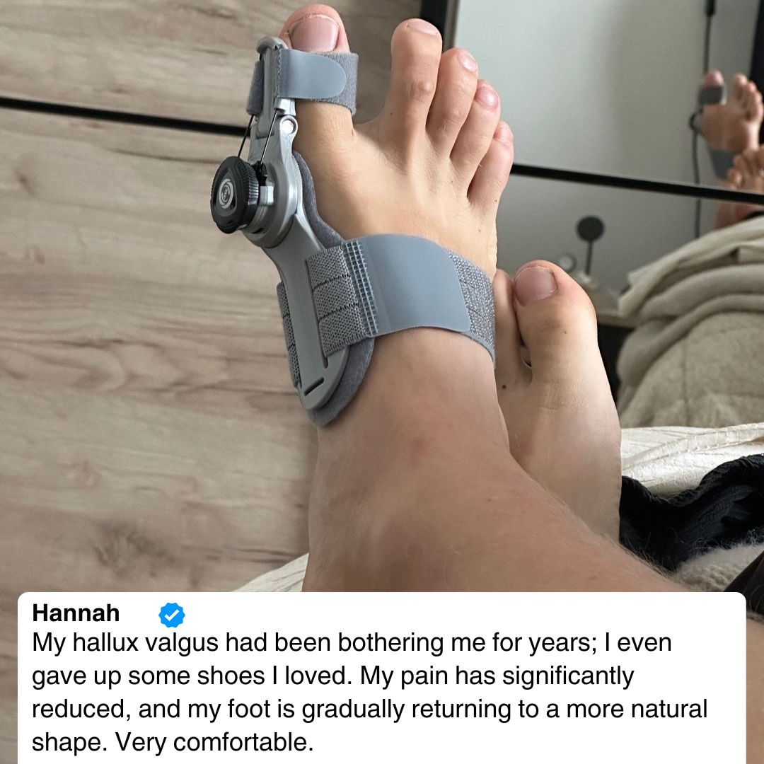 Bunion Corrector | Gentle, Ergonomic Design for Instant Pain Relief & Long-Term Correction