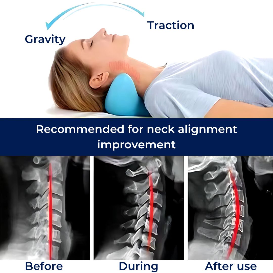 Neck Support Collar for Sleeping – Ergonomic Neck Rest Pillow for Posture, Stress Relief & Better Sleep