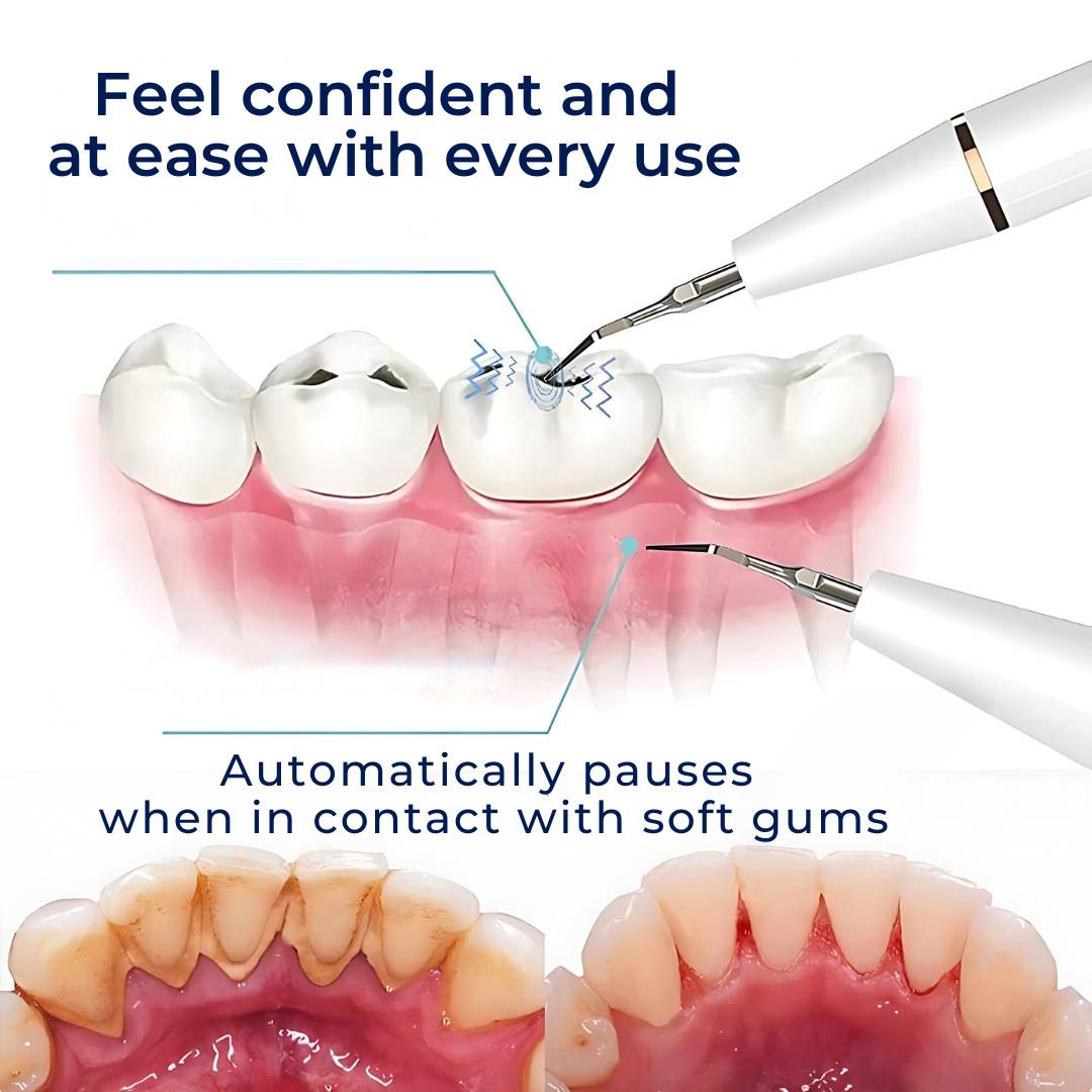Tartar Removal & Plaque Cleaner Kit – Ultrasonic Teeth Cleaner Device for At-Home Deep Dental Hygiene