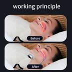 Anti Snoring Device – Dual Pulse Muscle Stimulator | Sleep Aid for Solve Snoring Support