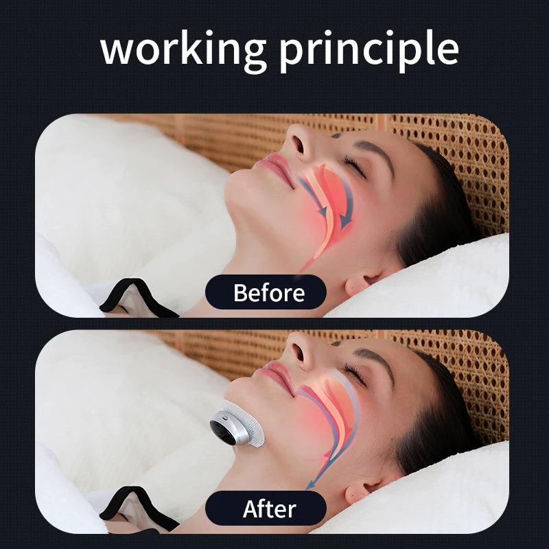 Anti Snoring Device – Dual Pulse Muscle Stimulator | Sleep Aid for Solve Snoring Support