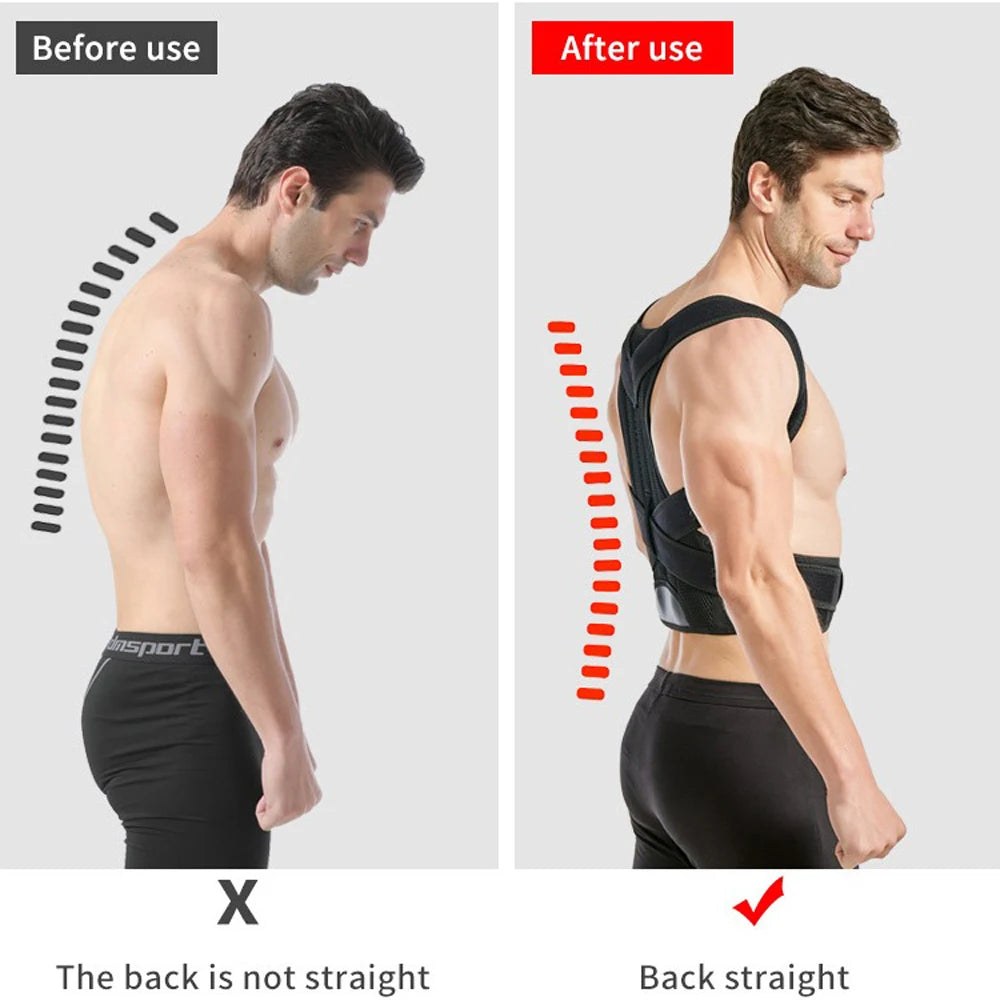 Posture Corrector – Upper Back & Shoulder Support | Adjustable Brace for Daily Wear at Home or Work